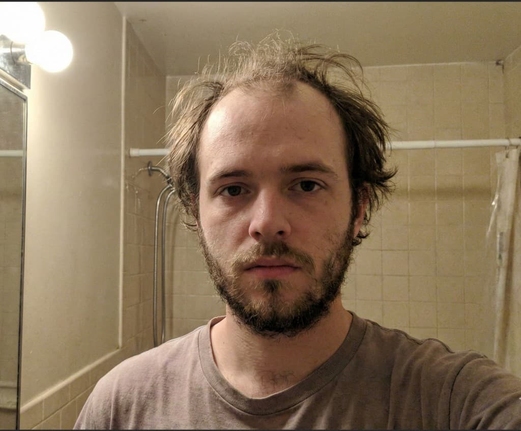 Before: feeling stuck, hiding from the mirror.